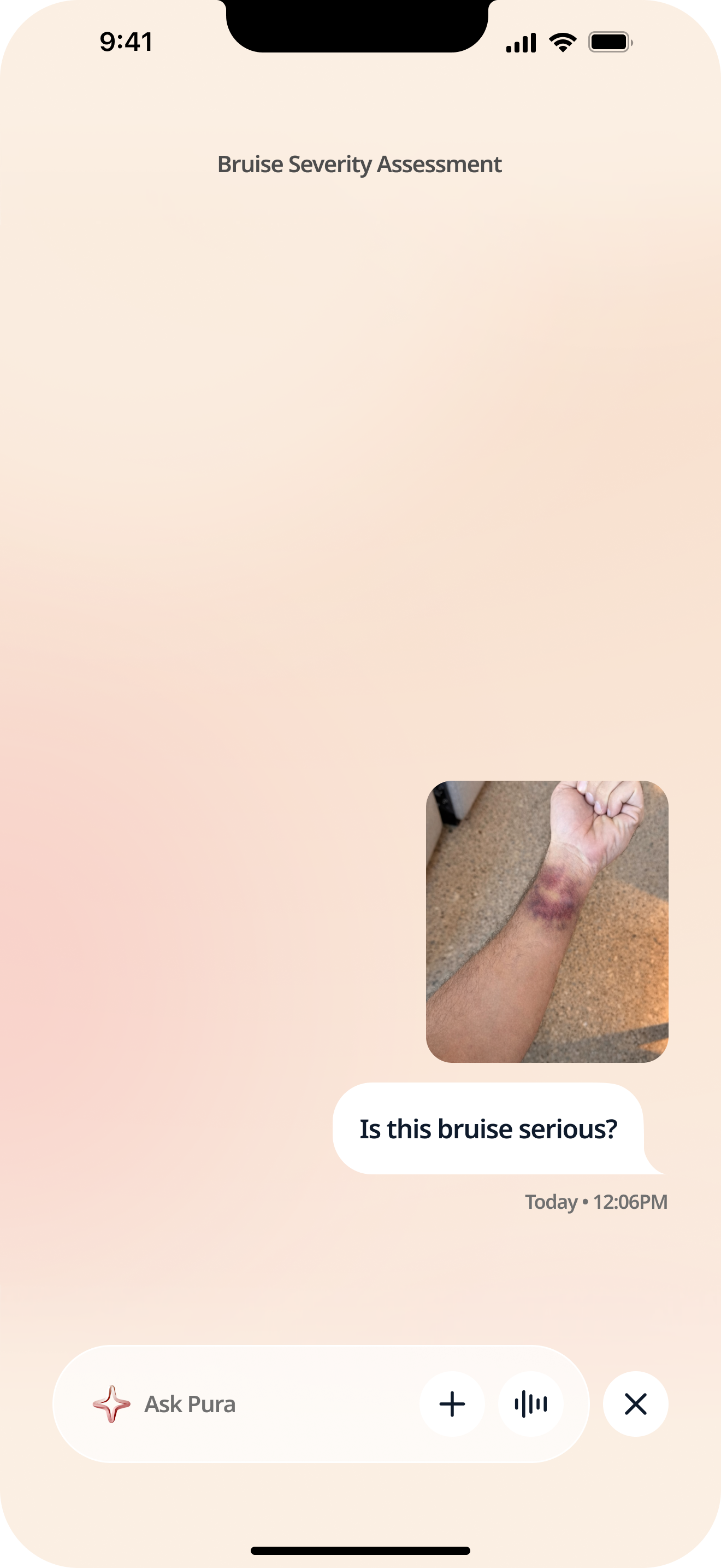 “Bruise Severity Assessment.”